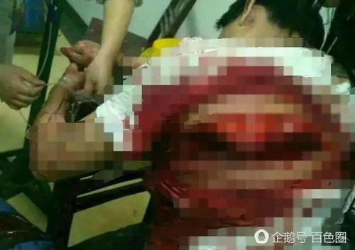 广西打架案件爆料最新,冲突升级，警方介入调查